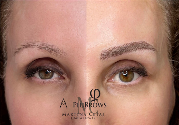 Microblading